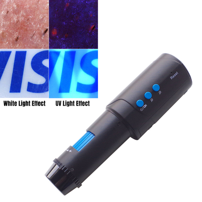 Good price HD 1080P Digital Dermatoscopy With UV Light For Mole Inspection online