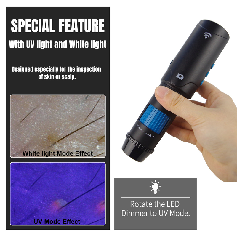 User-friendly Digital Dermatoscope with UV LED Light Source and Long-term Warranty